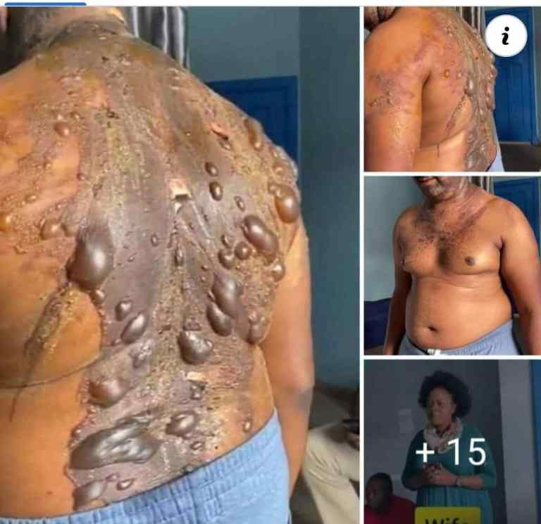 Exclusive: Wife Pours Hot Water On Husband For Buying iPhone For Side&nbsp;Chic