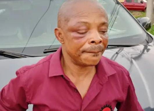 Owerri crises: NLC National President, Ajaero allegedly  brutalized by the&nbsp;police