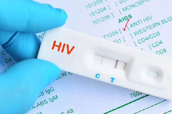 50,000 persons living with HIV in Osun, says&nbsp;O’SACA