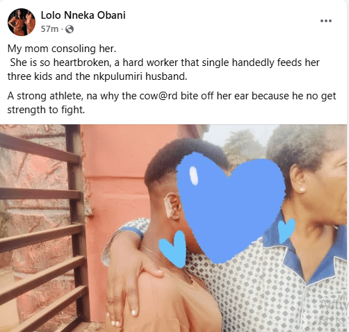 Drunk Man Bites Off His Wife’s Ear On Christmas Day