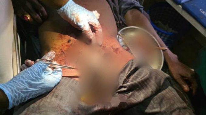 Fresh Details Surface as Man Cuts Off His Penis After Wife Refuses to Return&nbsp;Home